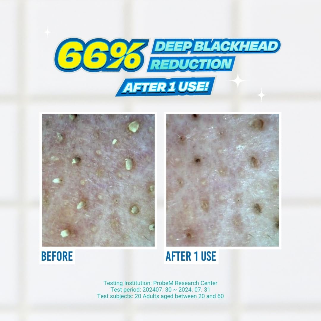 JUMISO dual-ended swabs showing cotton wipe and silicone tip for gentle removal benefit