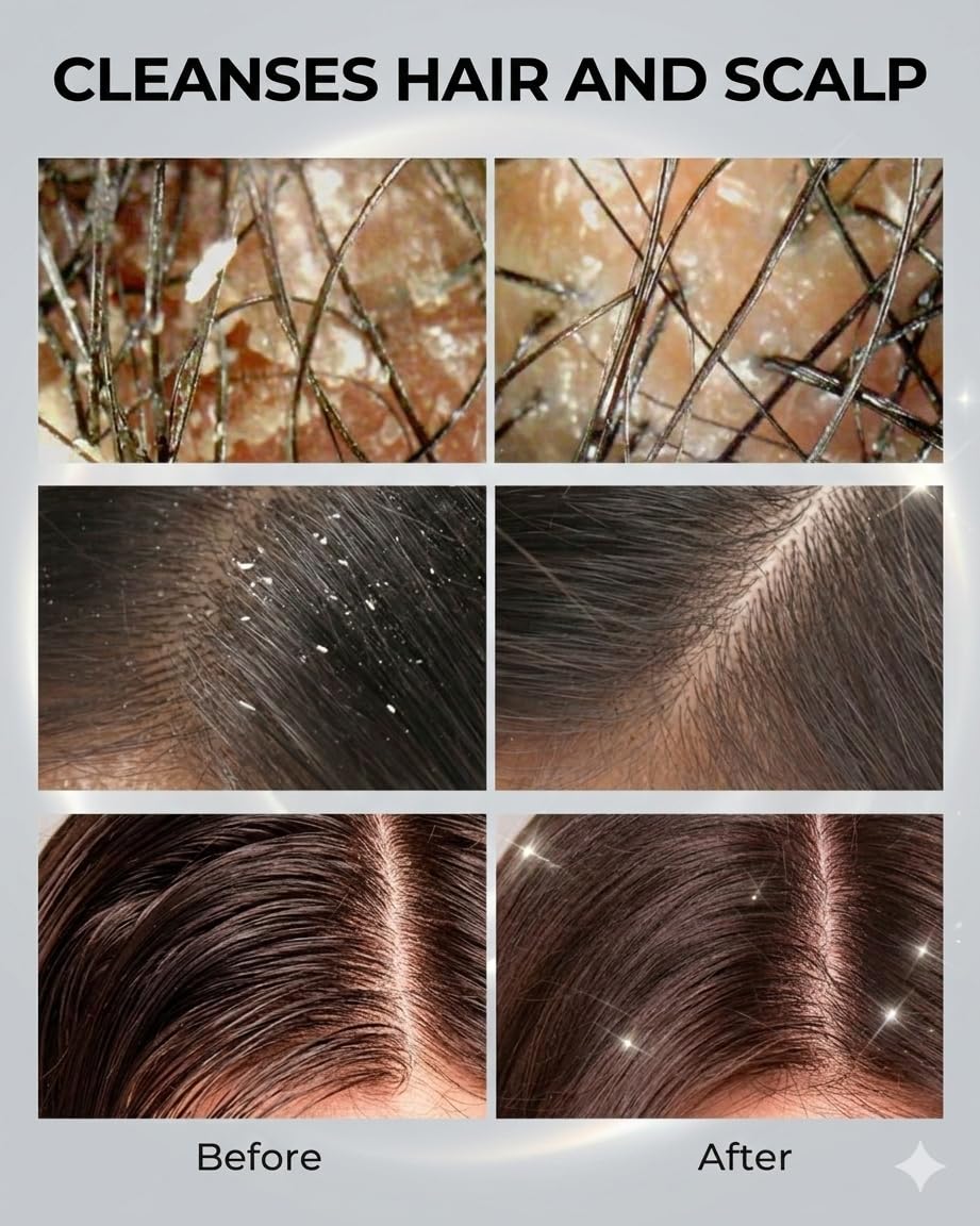 JVR scalp scrub being applied in shower to demonstrate cleansing action
