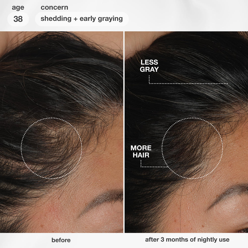 Applying K18 serum to scalp, targeted application supports reduced shedding
