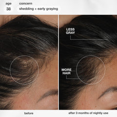 Applying K18 serum to scalp, targeted application supports reduced shedding