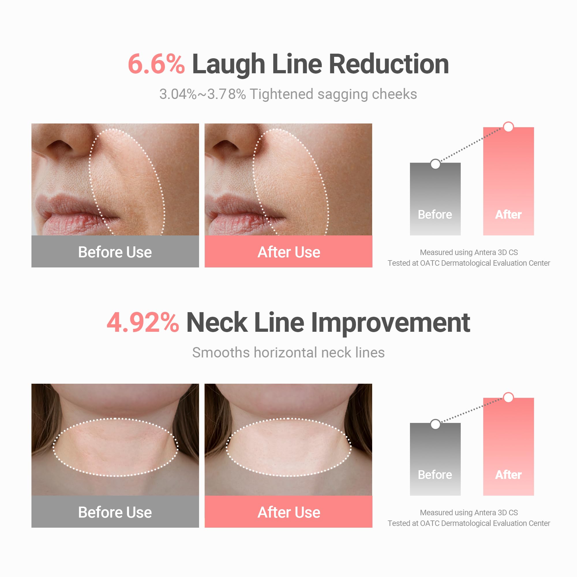 KAHI applied to cheek and nose illustrating glow and refined pores