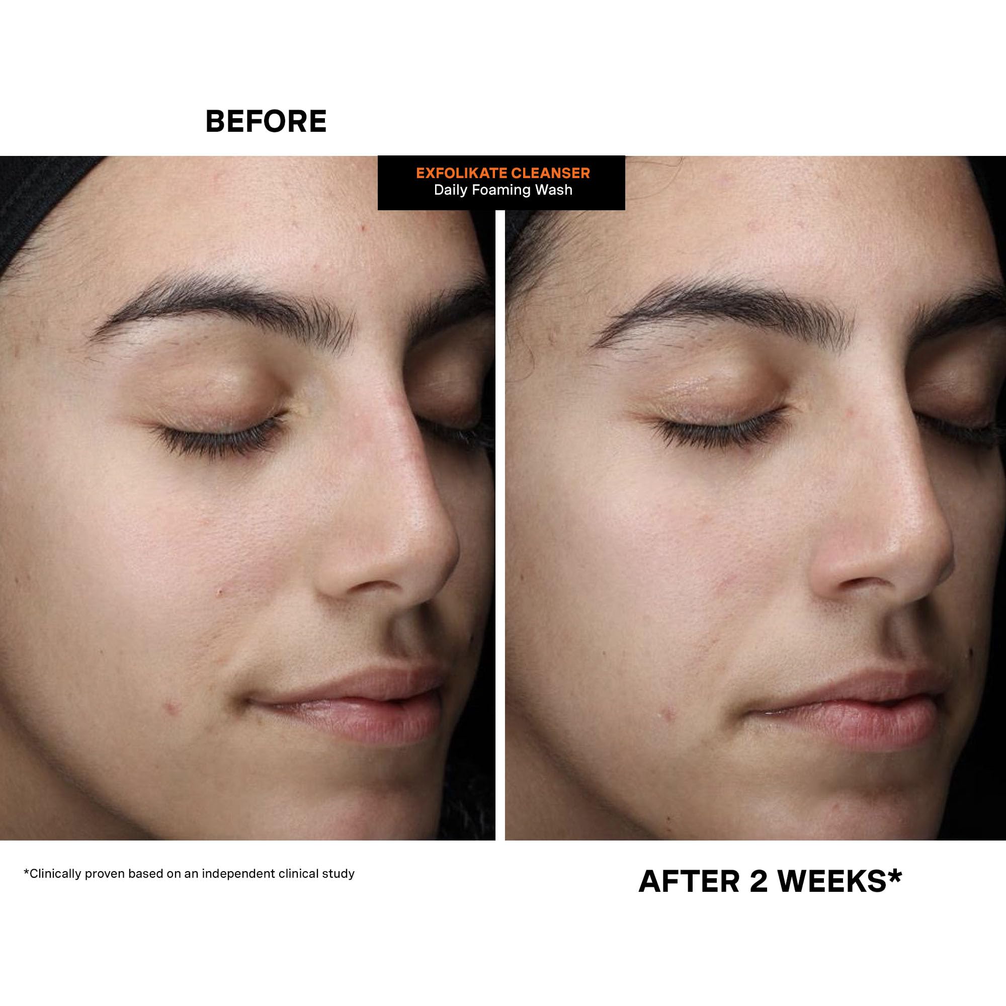 Clinic-style styling with Kate Somerville products conveying professional origins benefit