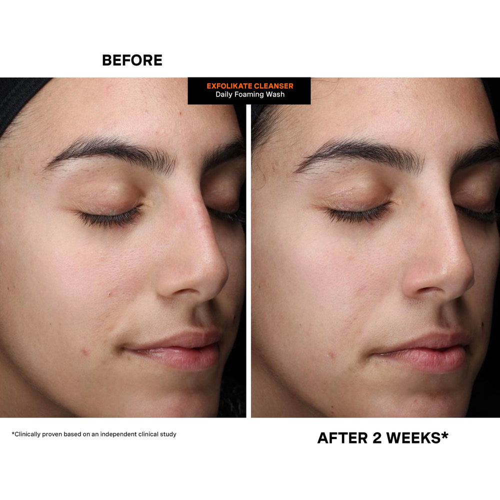 Clinic-style styling with Kate Somerville products conveying professional origins benefit