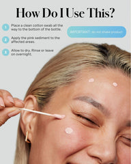 Kate Somerville product being applied to a pimple demonstrating targeted spot use
