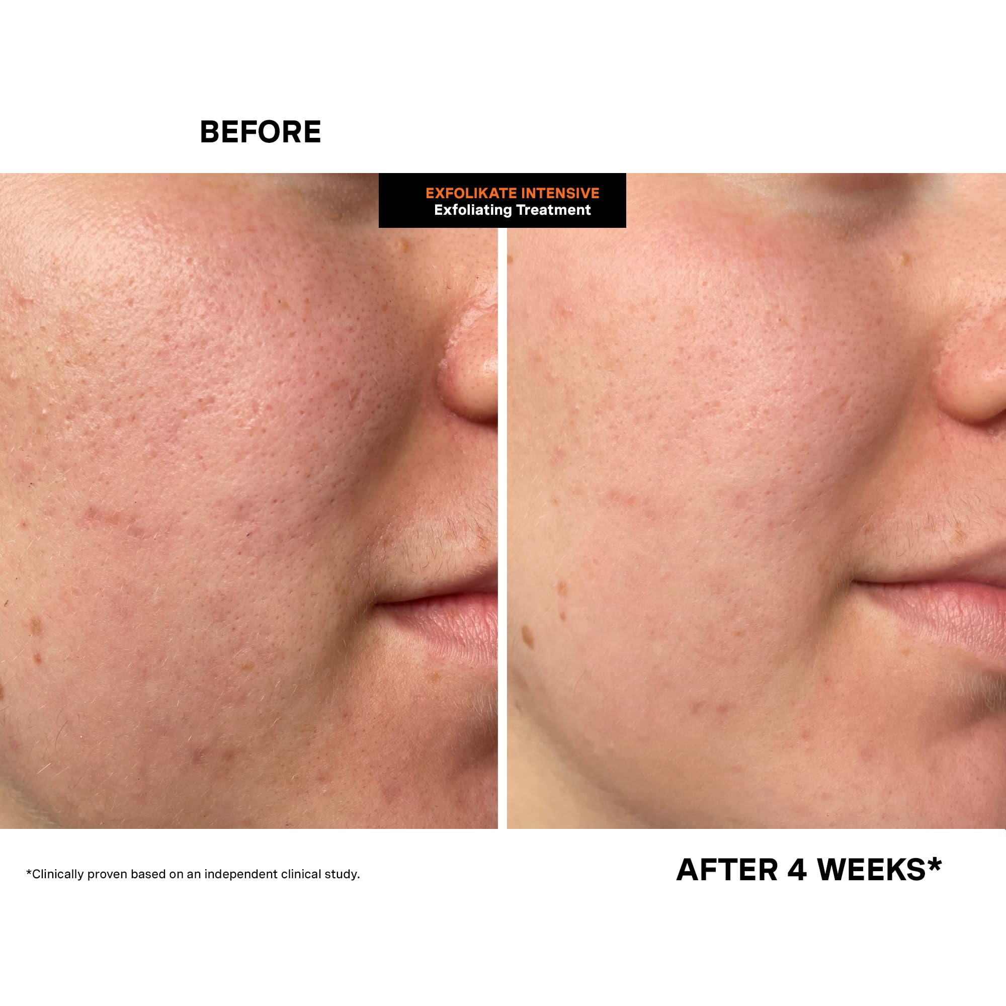 Kate Somerville product on hand demonstrating quick two-minute use advantage