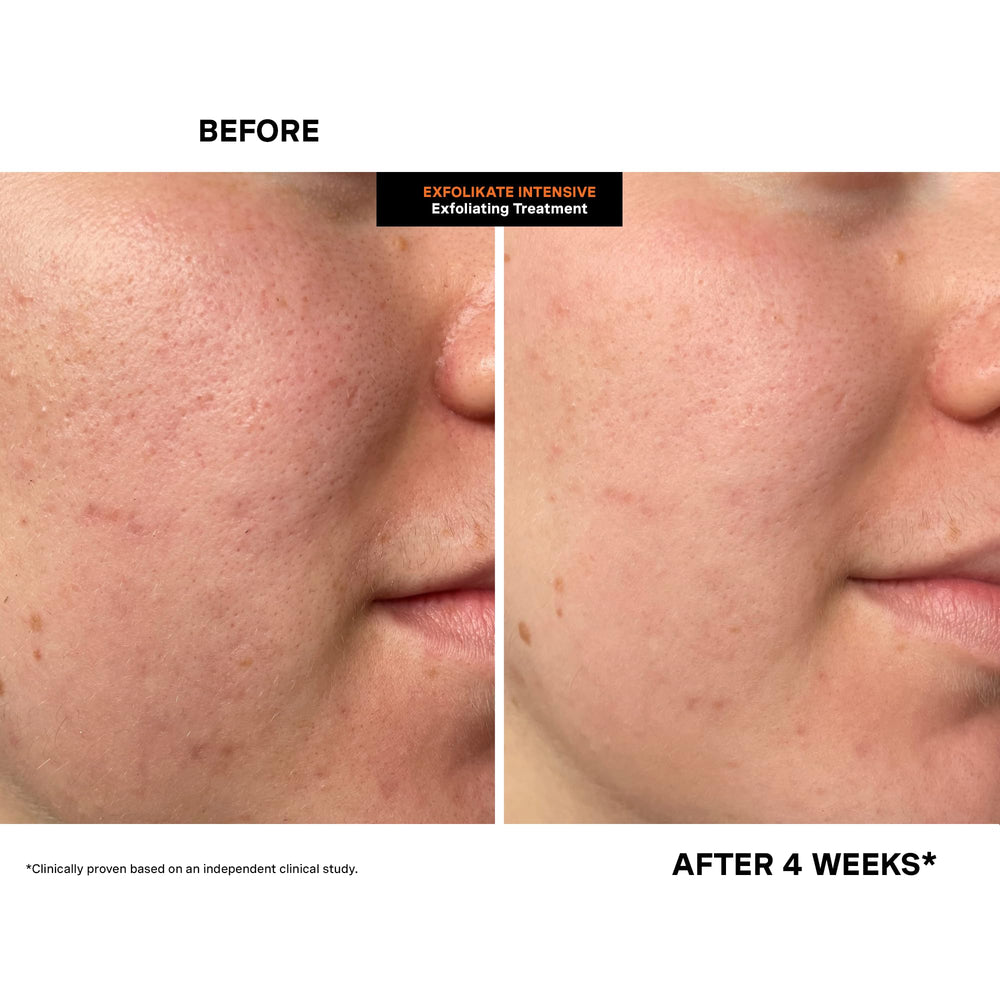 Kate Somerville product on hand demonstrating quick two-minute use advantage