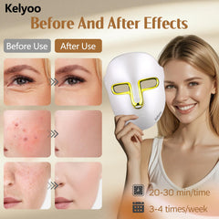 Kelyoo close-up of 119 LEDs and mask texture for even light distribution