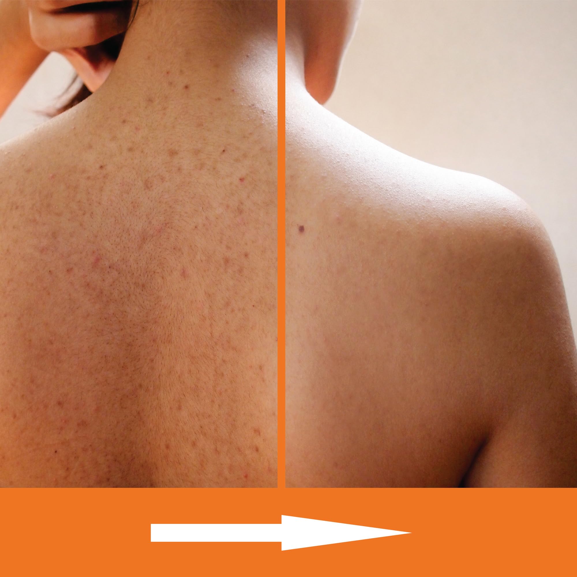 KERAPIL ingredients close-up with ceramides aloe jojoba for hydration
