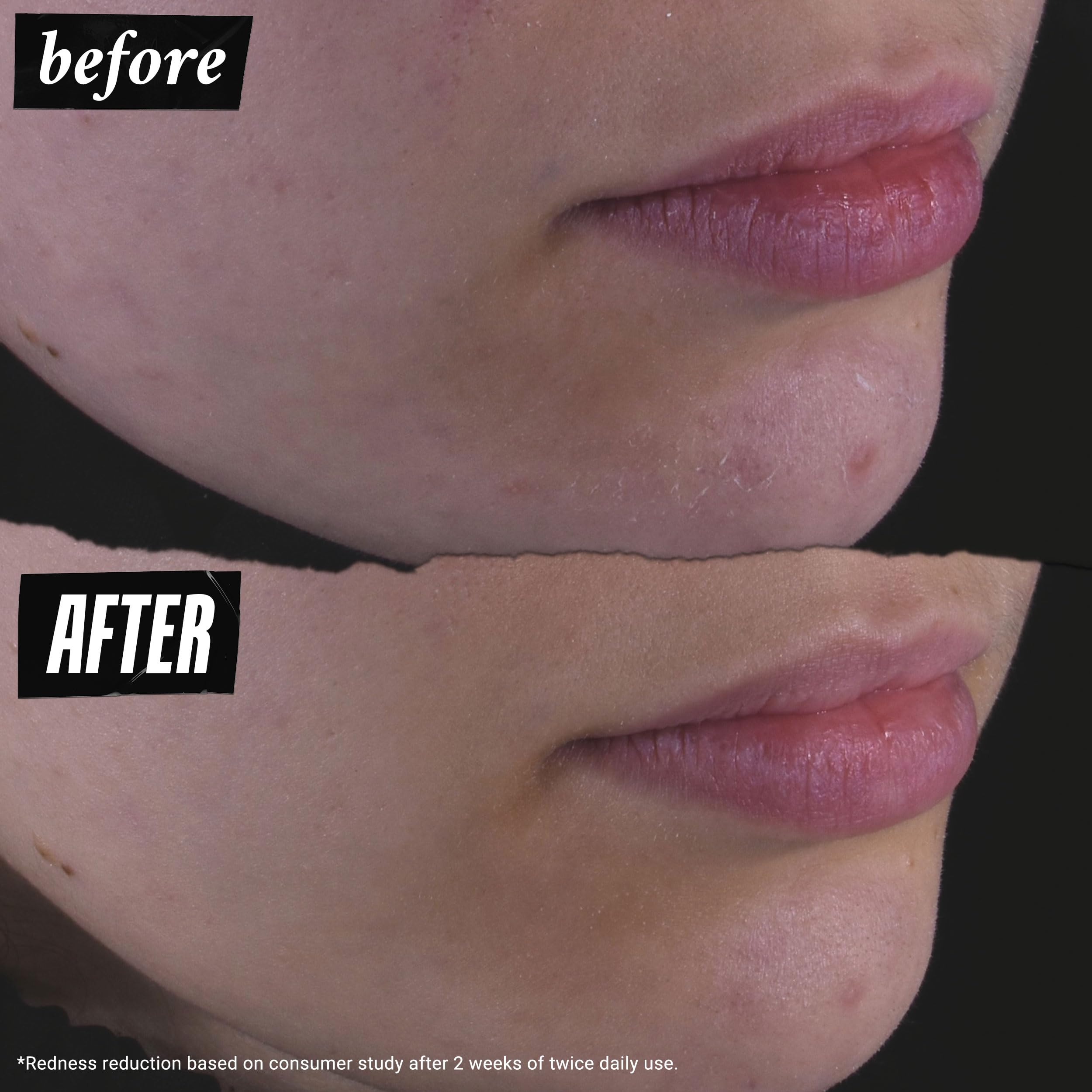 Kiehl's product being patted into skin showing gentle application benefit