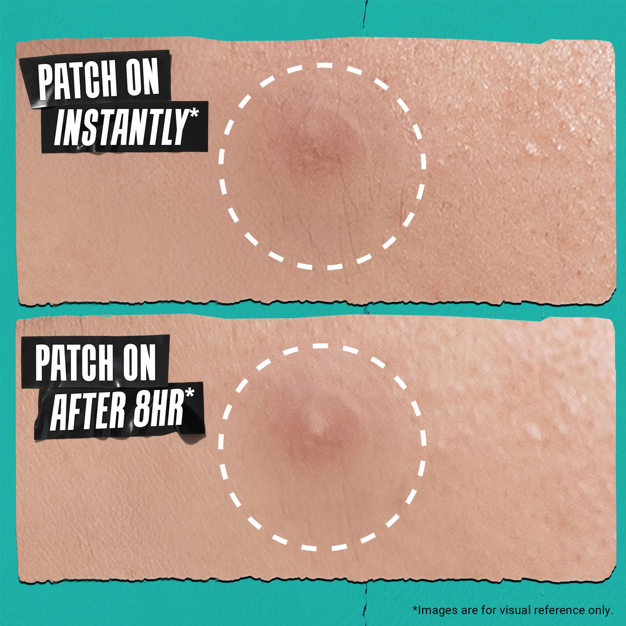 Kiehl's patches on fingertip illustrating discreet, thin coverage