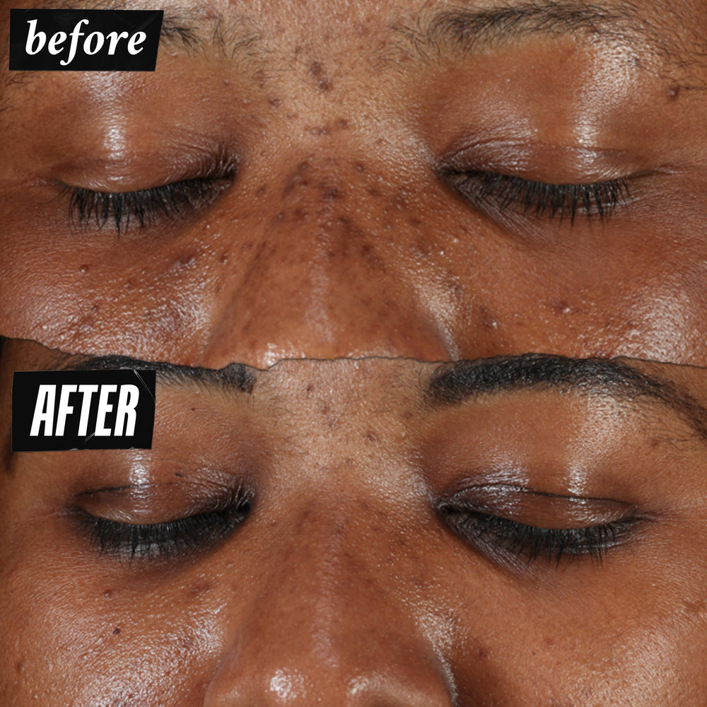 Kiehl's serum texture on hand showing lightweight absorption benefit