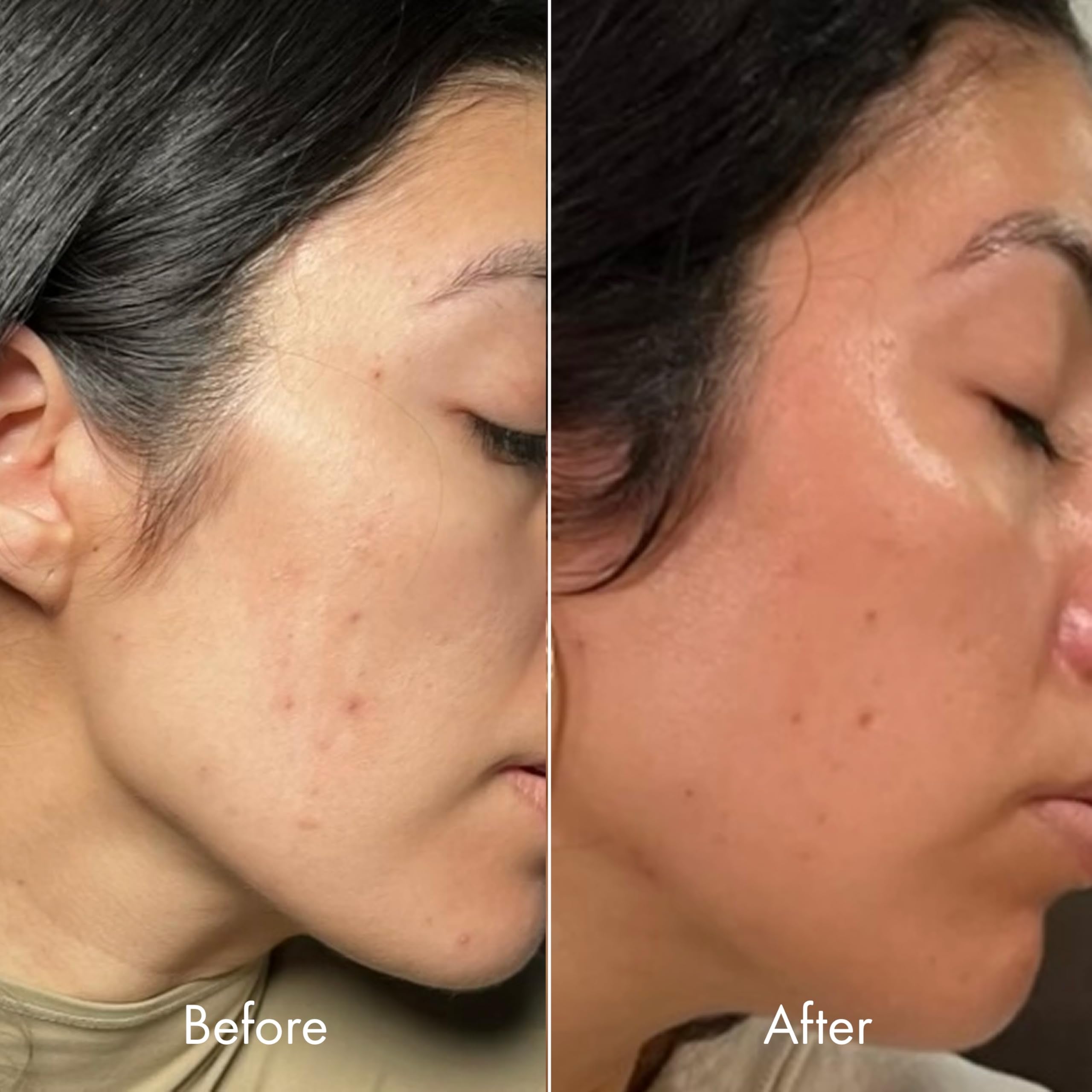 Kopari ingredient focus with hyaluronic acid visuals for moisture retention