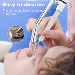 KOSIMAI illuminated 8-LED ring demonstrating bright, shadow-free lighting for safer extractions
