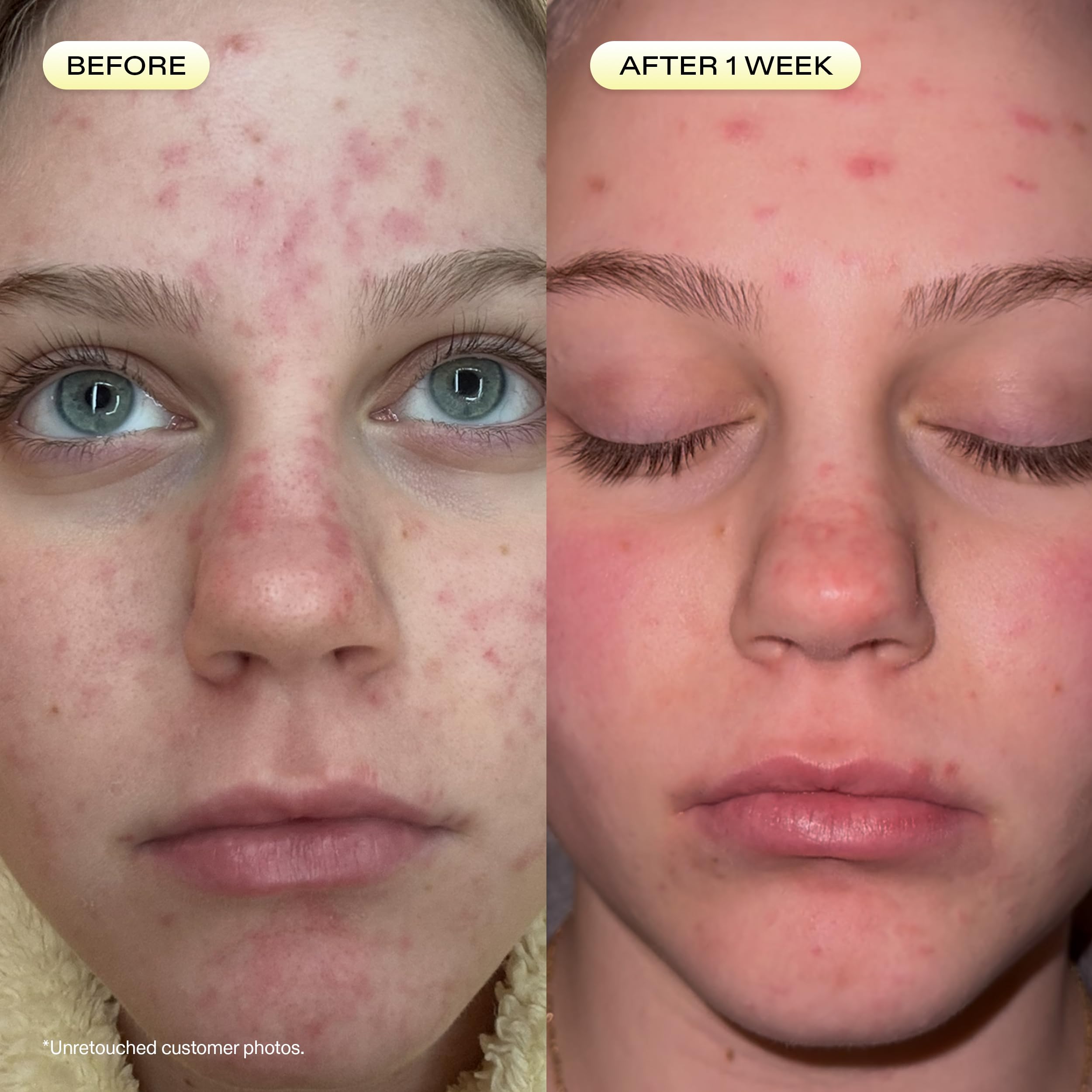 KraveBeauty rosehip oil bottle next to product conveying skin-conditioning benefits and lipid support