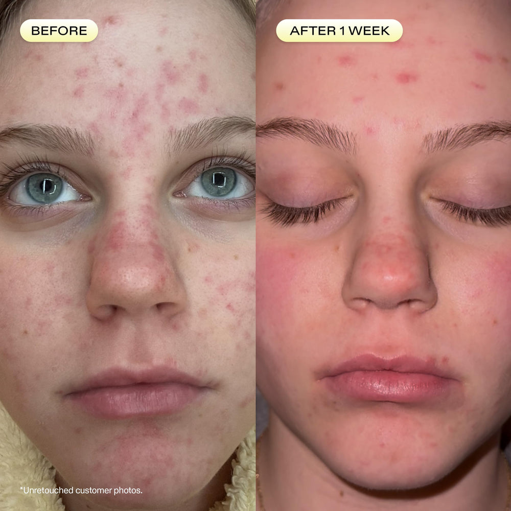 KraveBeauty rosehip oil bottle next to product conveying skin-conditioning benefits and lipid support