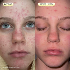 KraveBeauty rosehip oil bottle next to product conveying skin-conditioning benefits and lipid support