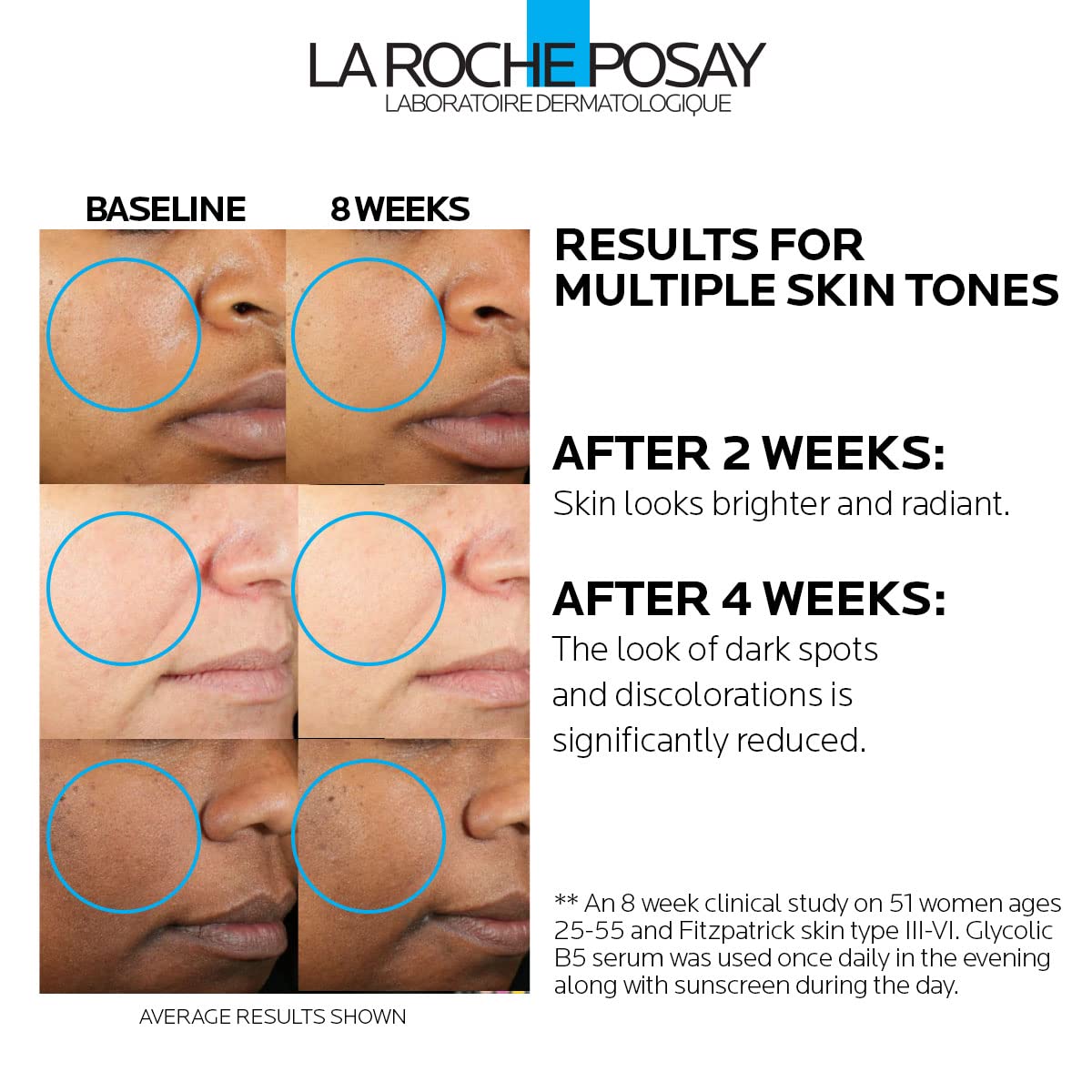 La Roche-Posay dropper dispensing serum highlighting precise application