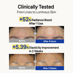 Wooshin Labottach patches applied on forehead demonstrating comfortable overnight wear