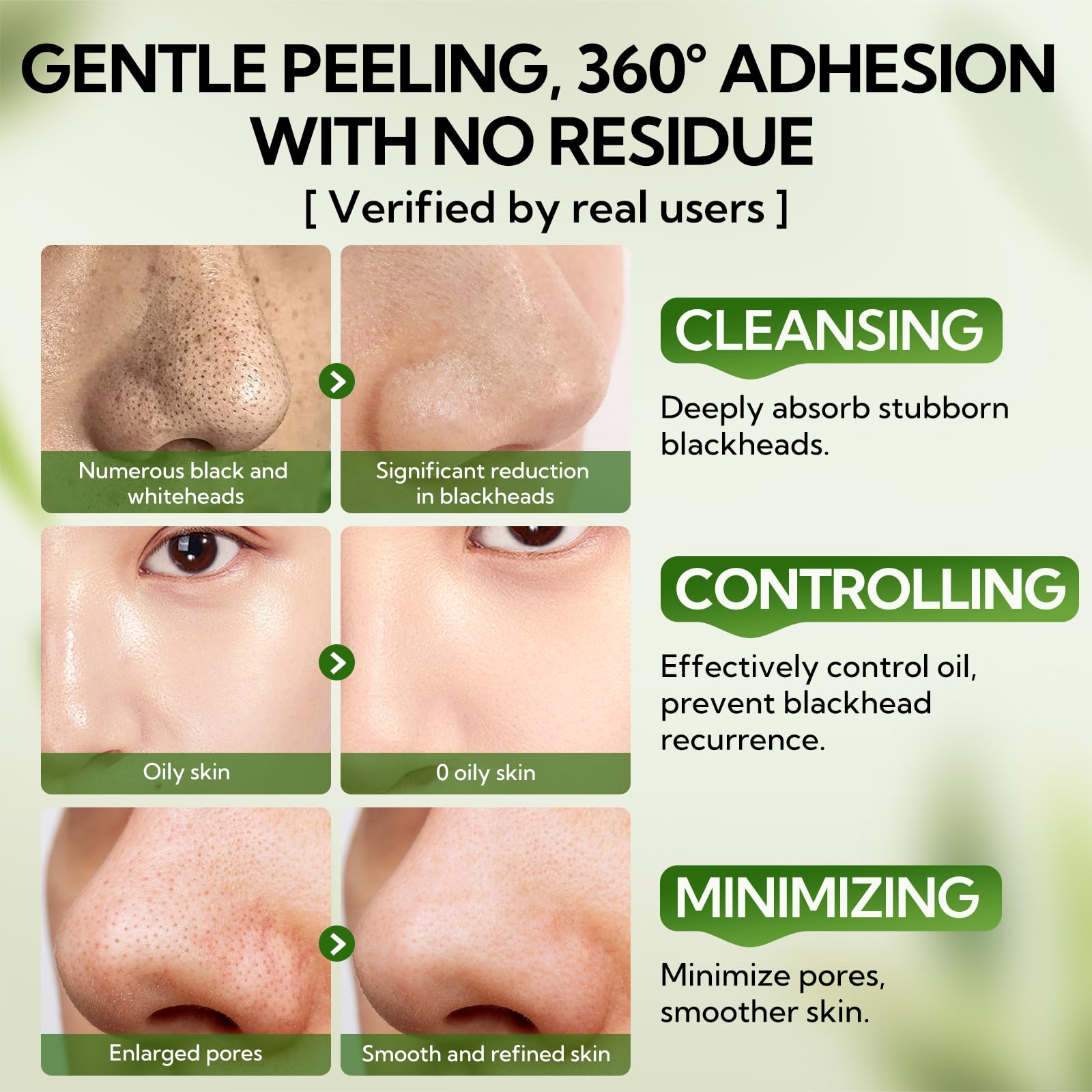 LANBENA before and after nose comparison showing clearer pores
