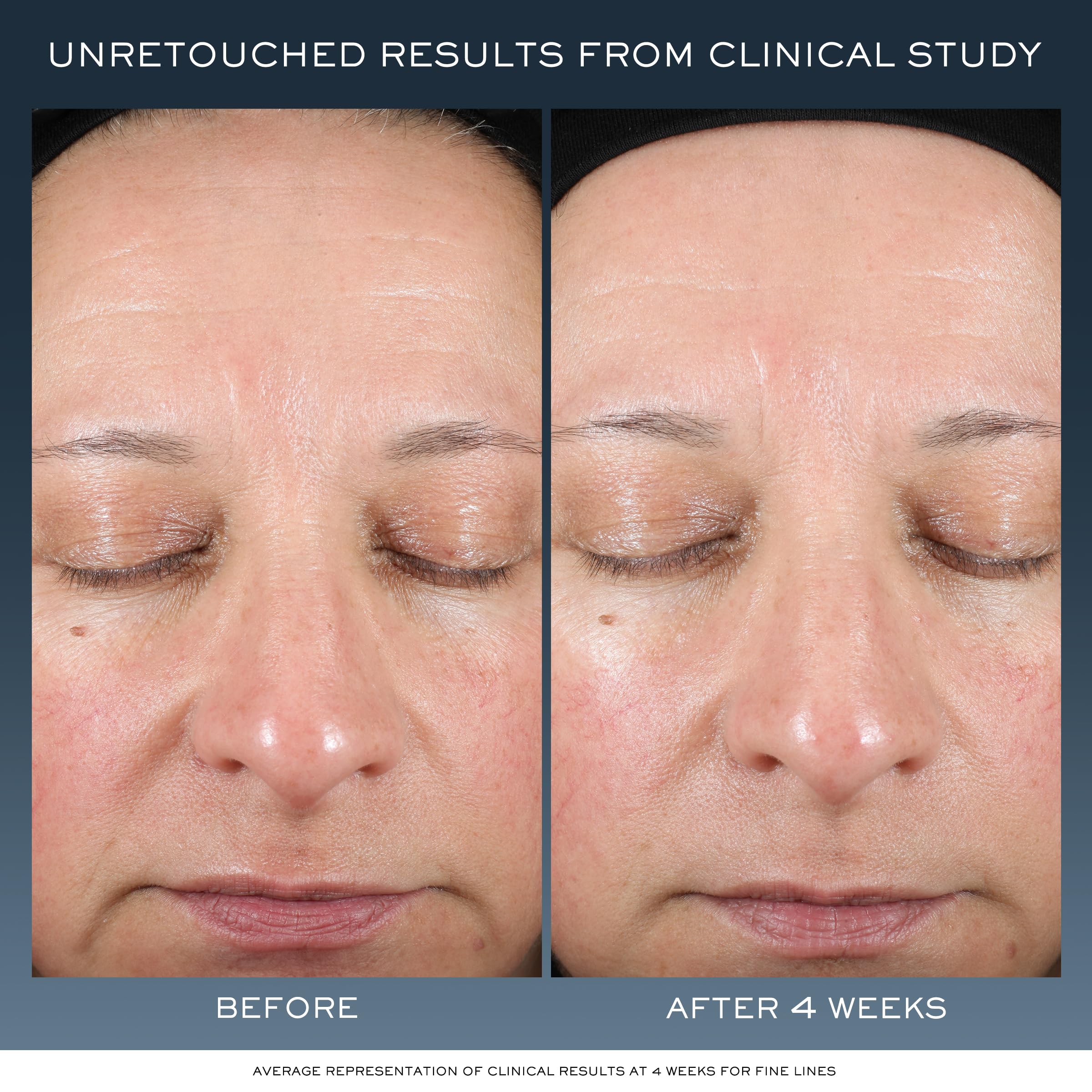 Lancôme cream texture close-up highlighting melting hydration benefit