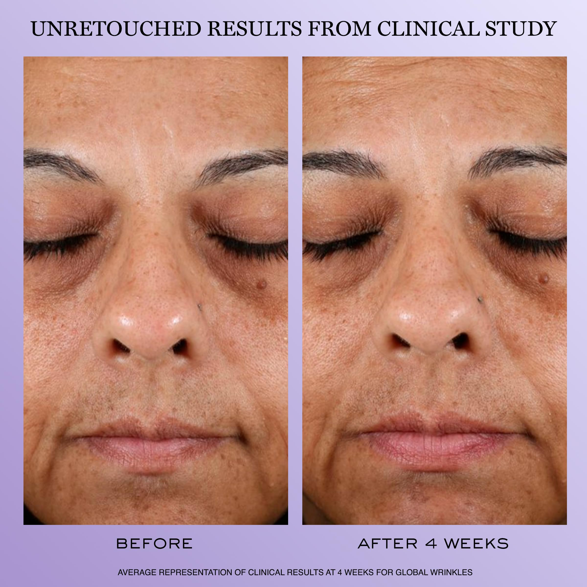 Lancôme peptide complex visual with molecules, emphasizes elasticity-boosting benefits