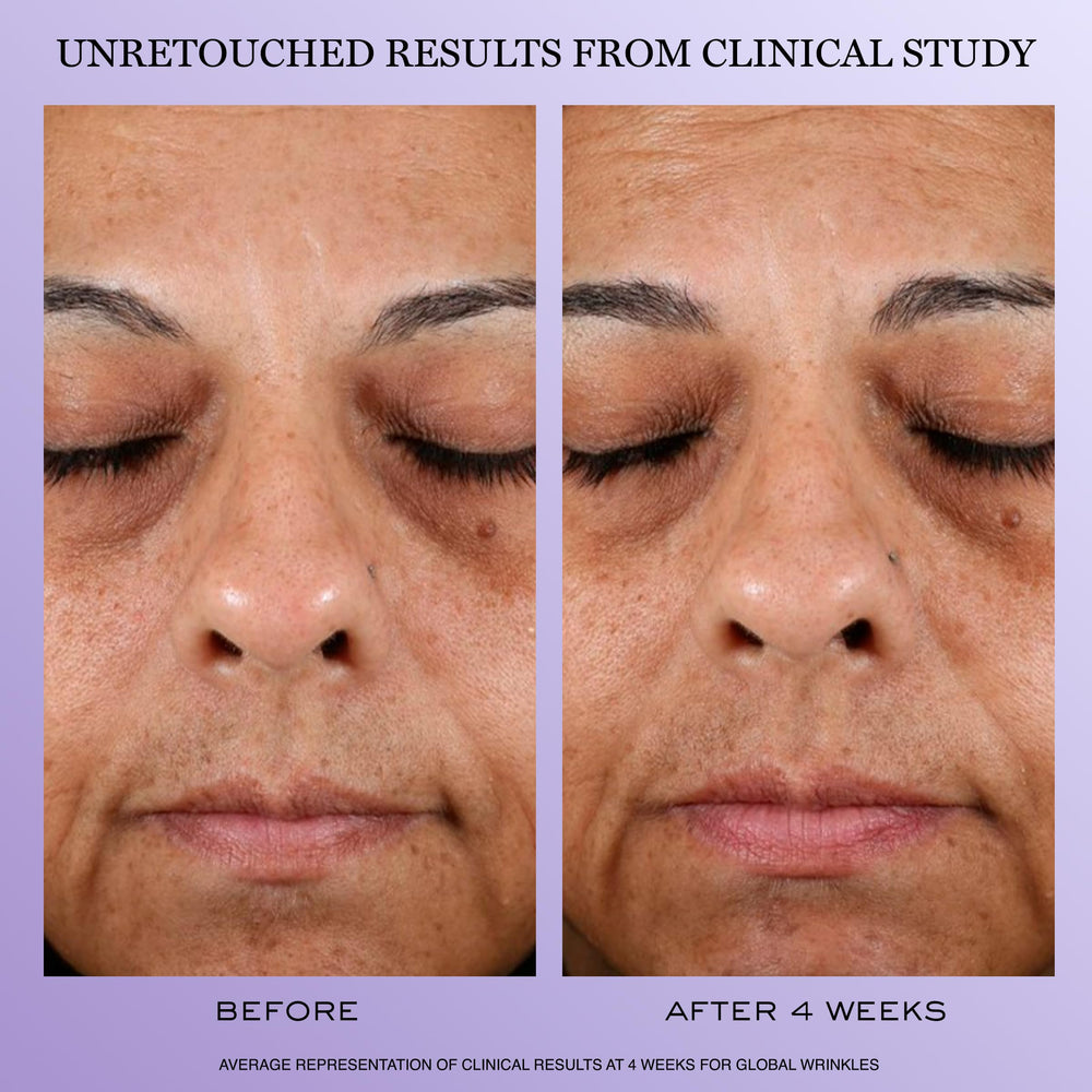 Lancôme peptide complex visual with molecules, emphasizes elasticity-boosting benefits