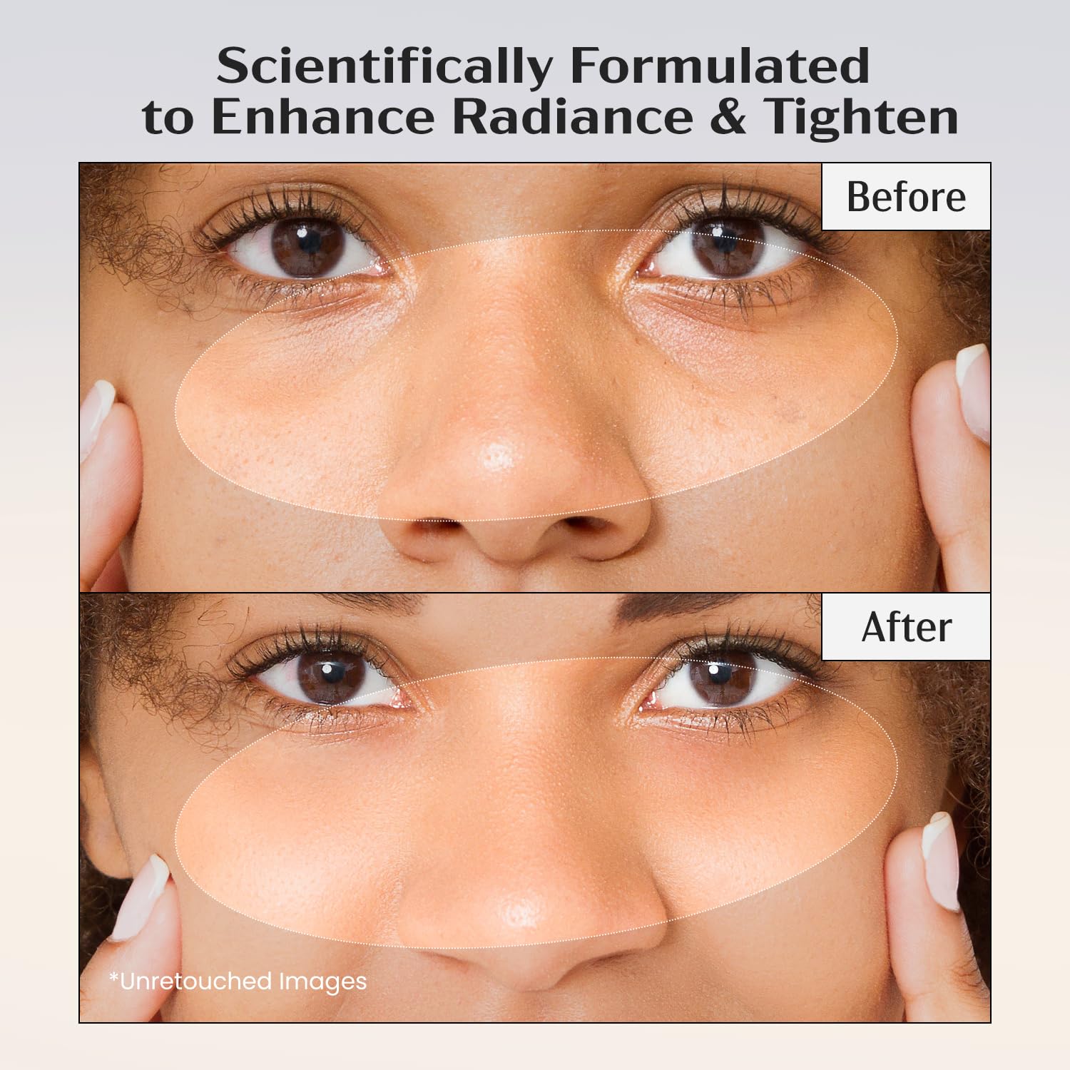 Lanmeri Ceuticals close-up of hyaluronic acid and ectoin, supports hydration