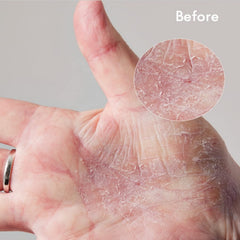 Lanolips being smoothed onto a hand demonstrating fast protective hydration