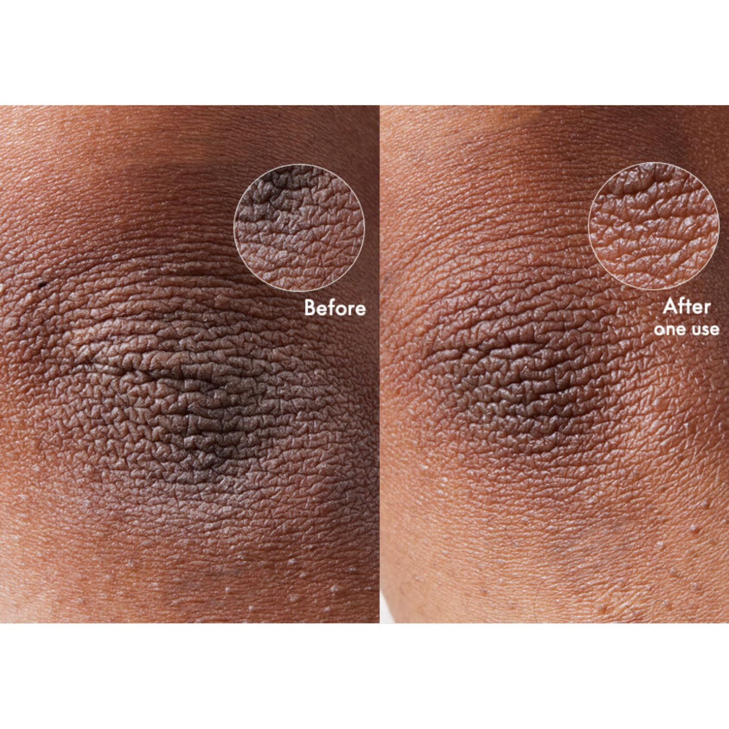 Lanolips applied to facial dry patch showing gentle targeted nourishment