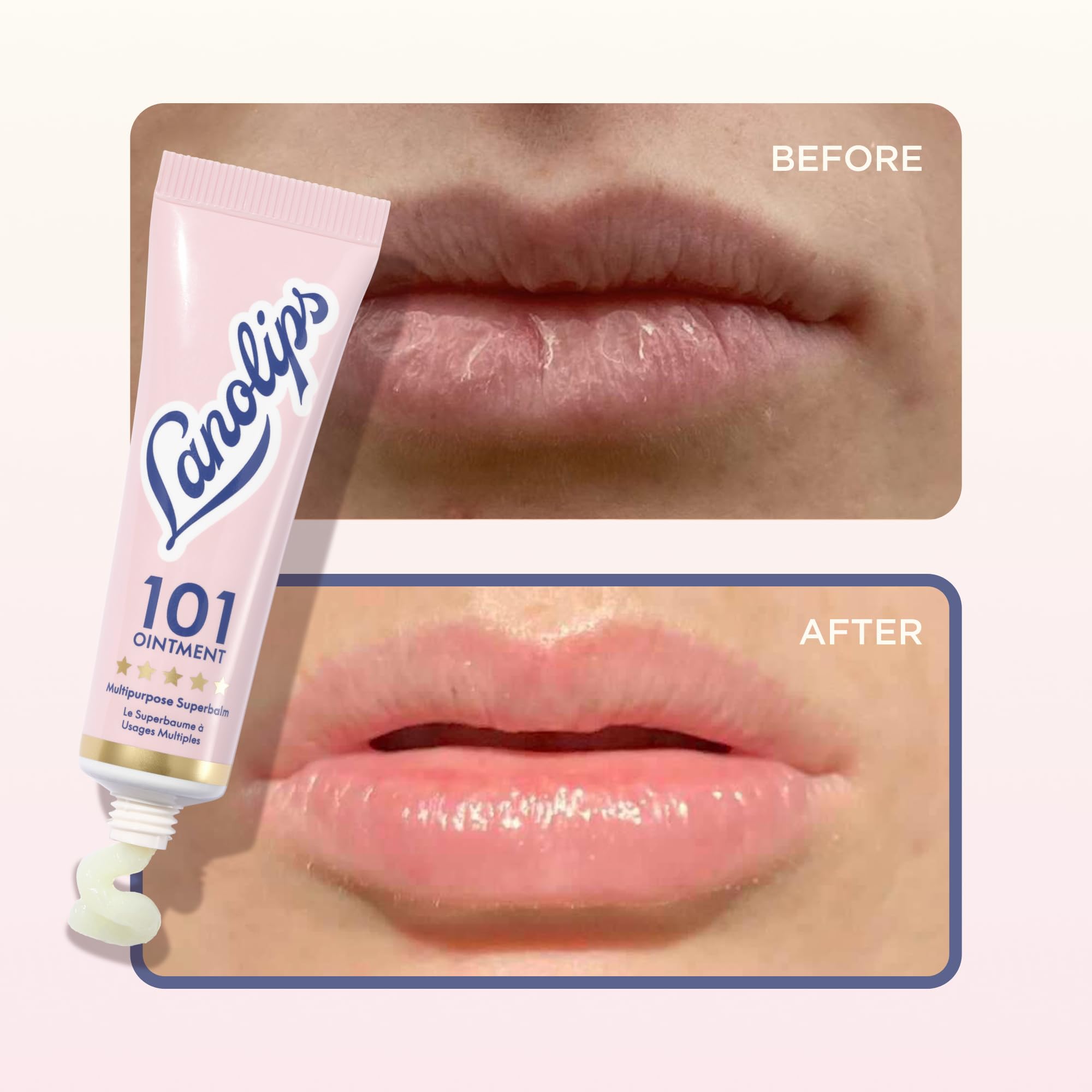 Lanolips applied to elbow in lifestyle shot demonstrating rough-skin smoothing