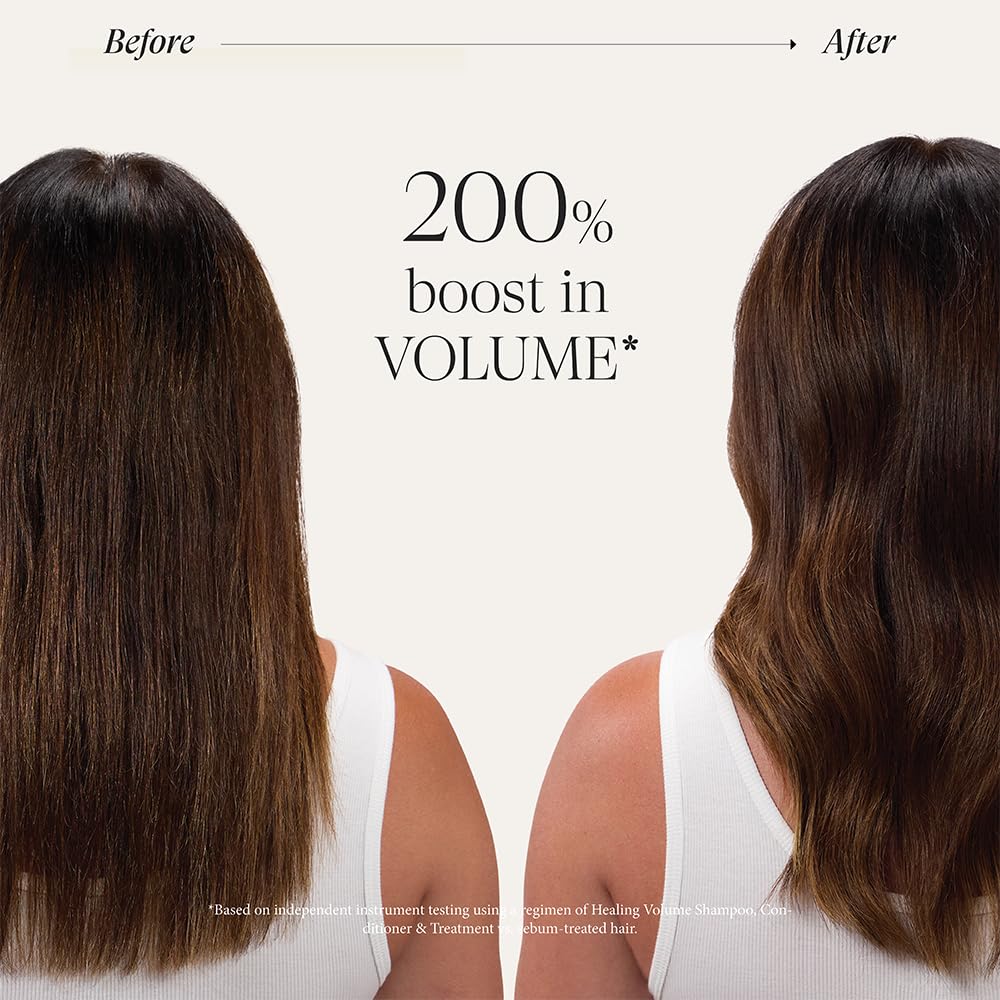 L’ANZA before and after comparison illustrating visible fuller, thicker hair