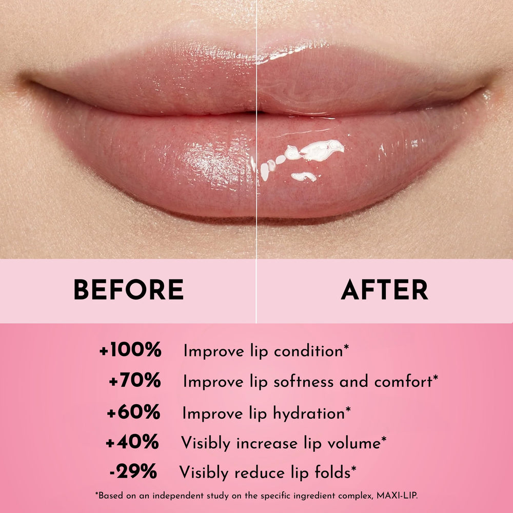 LAWLESS before-and-after lip comparison showing smoother lines and fuller appearance benefit