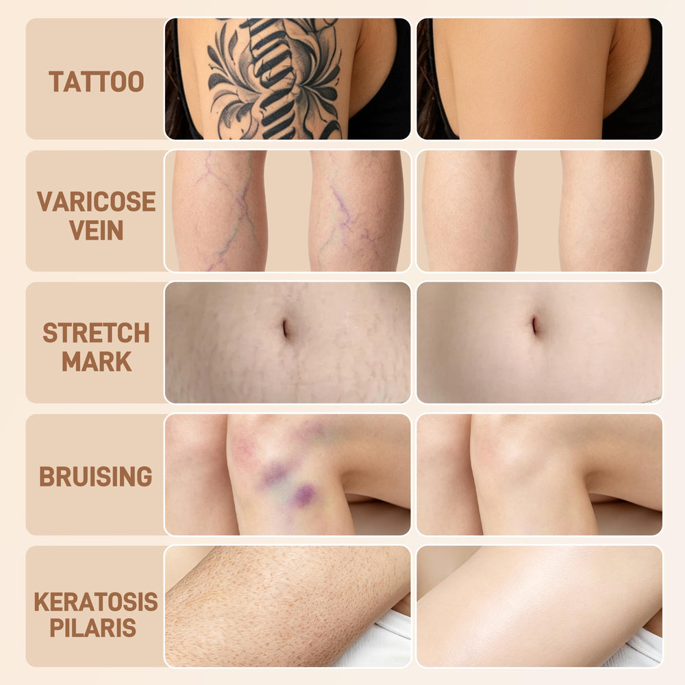 LELB before and after leg coverage illustrating concealment of tattoo and scars