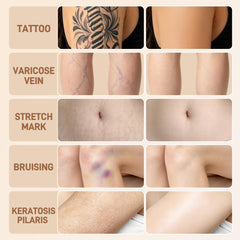 LELB before and after leg coverage illustrating concealment of tattoo and scars