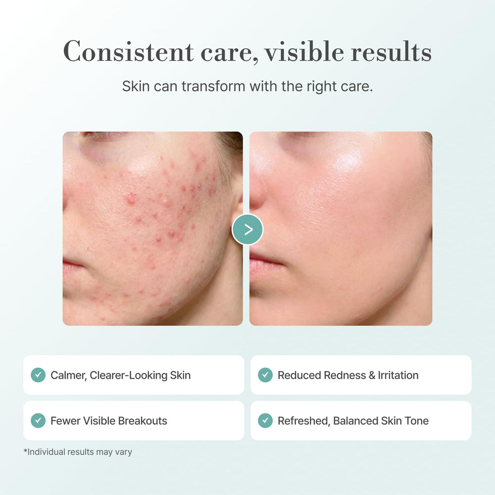 Lepique mist dispersing on skin showing lightweight texture and no-residue benefit