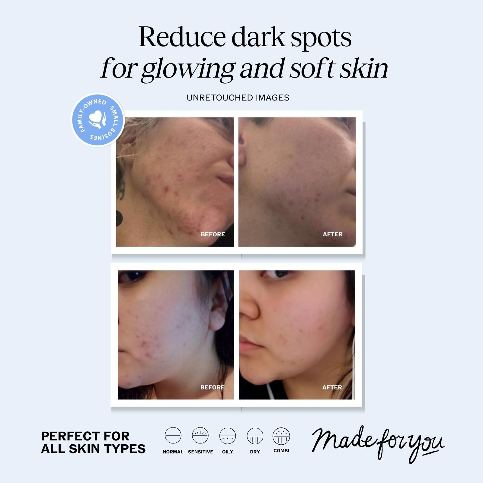 LilyAna Naturals serum dropper releasing clear drop, demonstrating easy application