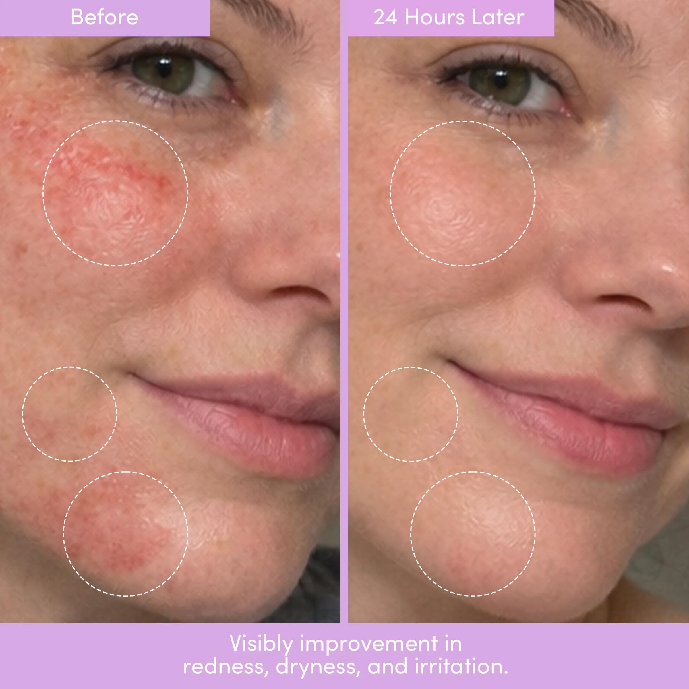 LION POSE ceramide ingredient visual emphasizing barrier support benefits