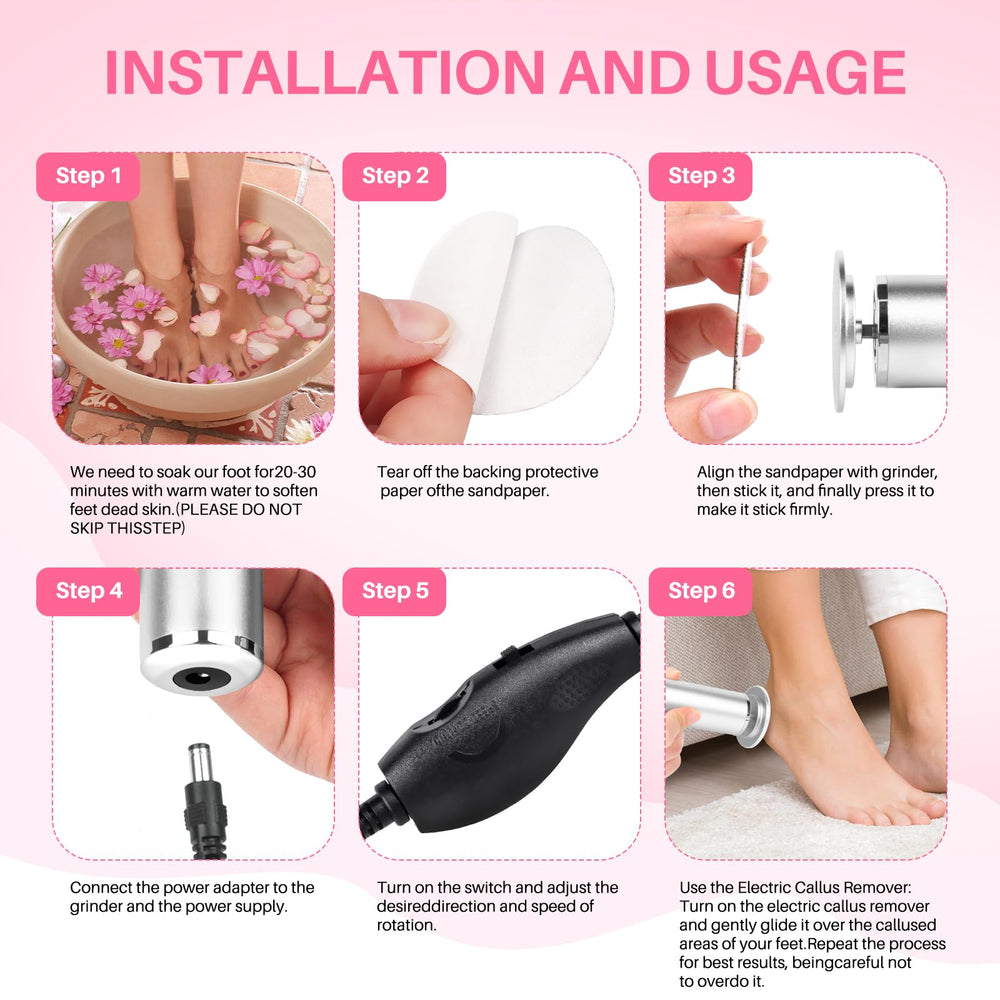 LIONVISON product packaging and accessories display for complete kit clarity