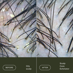 Living Proof close-up of direct-tip applicator for targeted scalp delivery