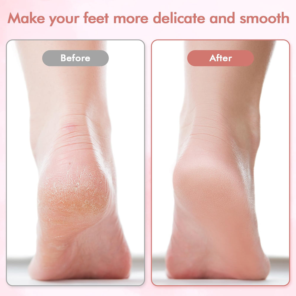LIYUJSDZ coarse grinding head detail for removing stubborn calluses and hard skin