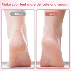 LIYUJSDZ coarse grinding head detail for removing stubborn calluses and hard skin