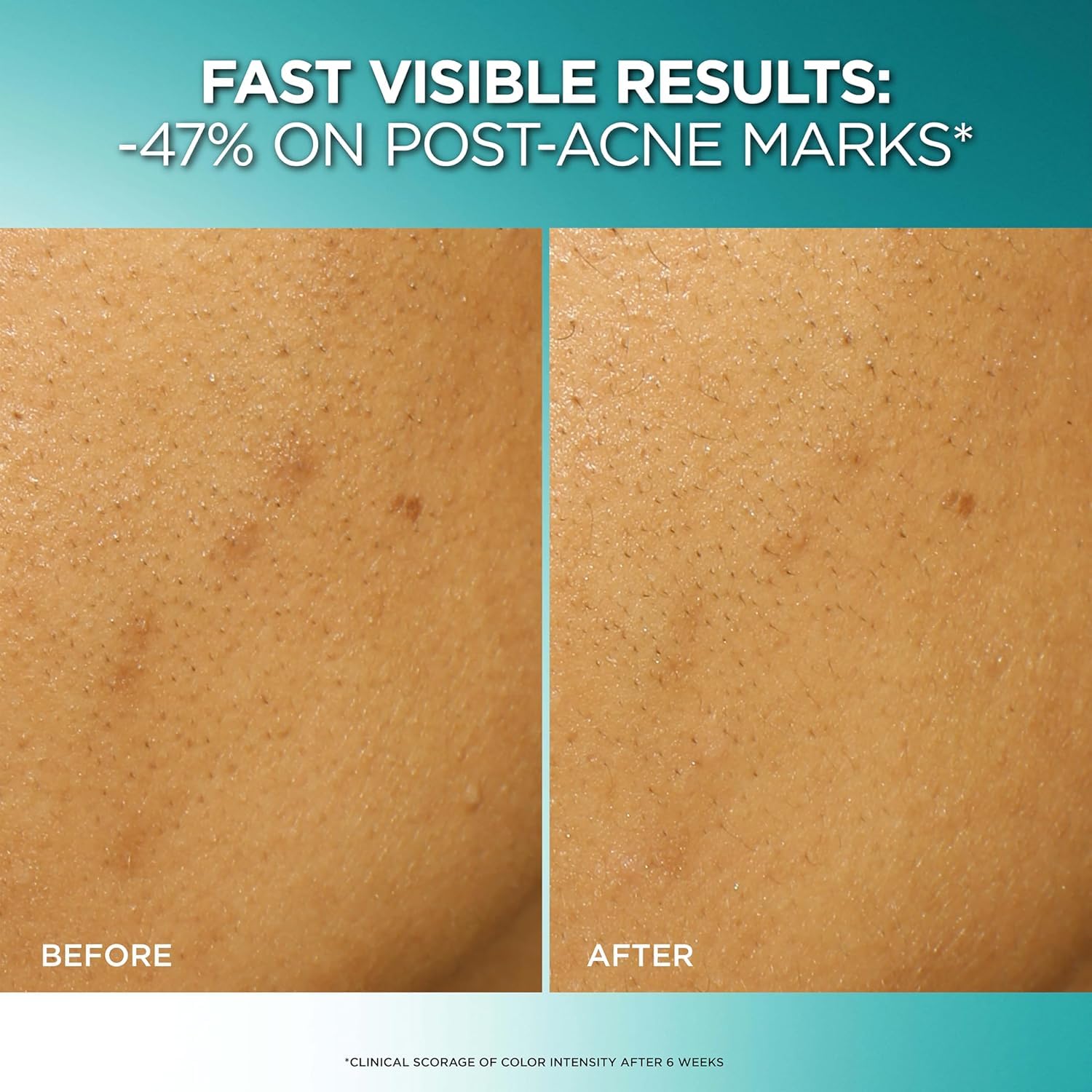 L'Oreal Paris clear-tip applicator close-up for precise dispensing benefit