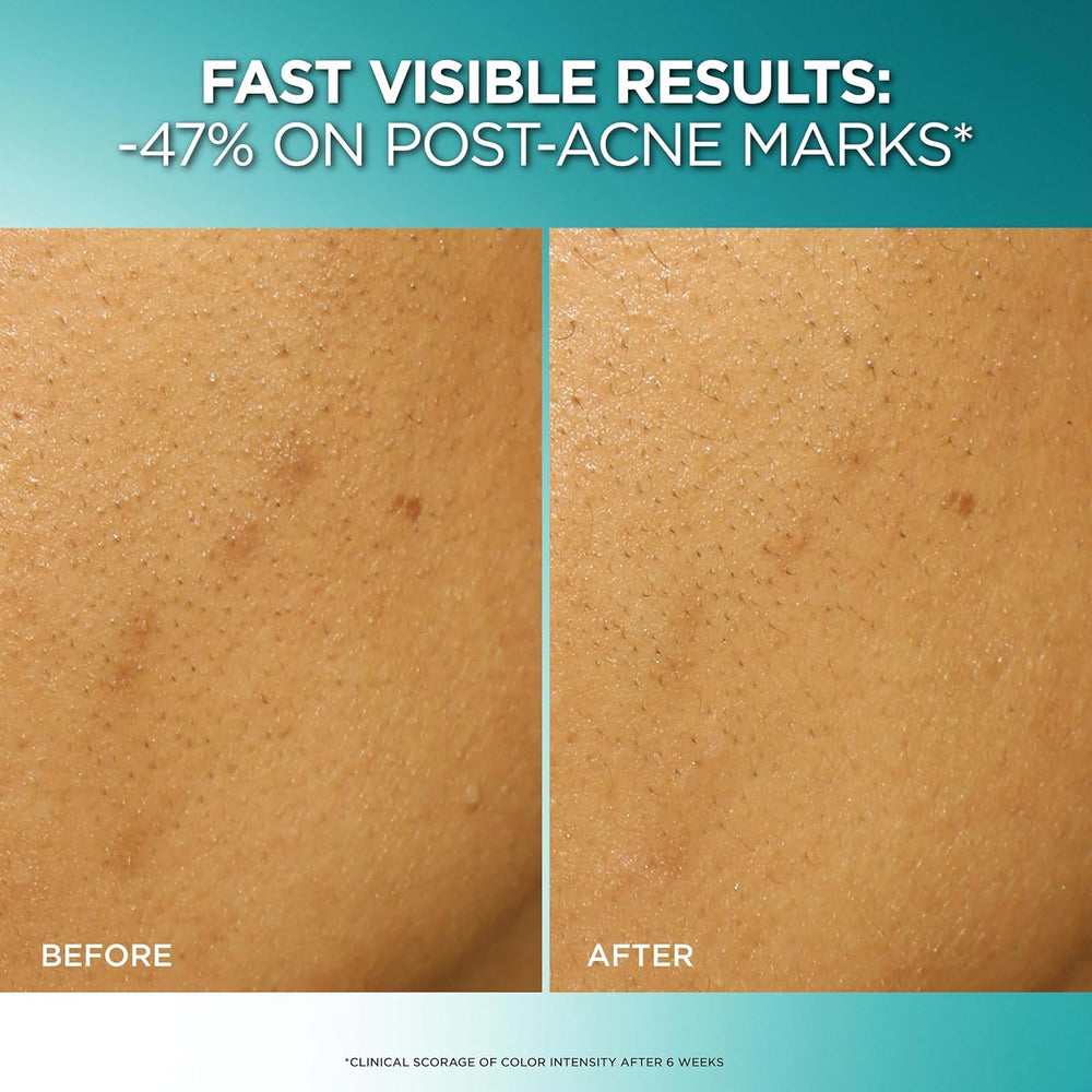 L'Oreal Paris clear-tip applicator close-up for precise dispensing benefit