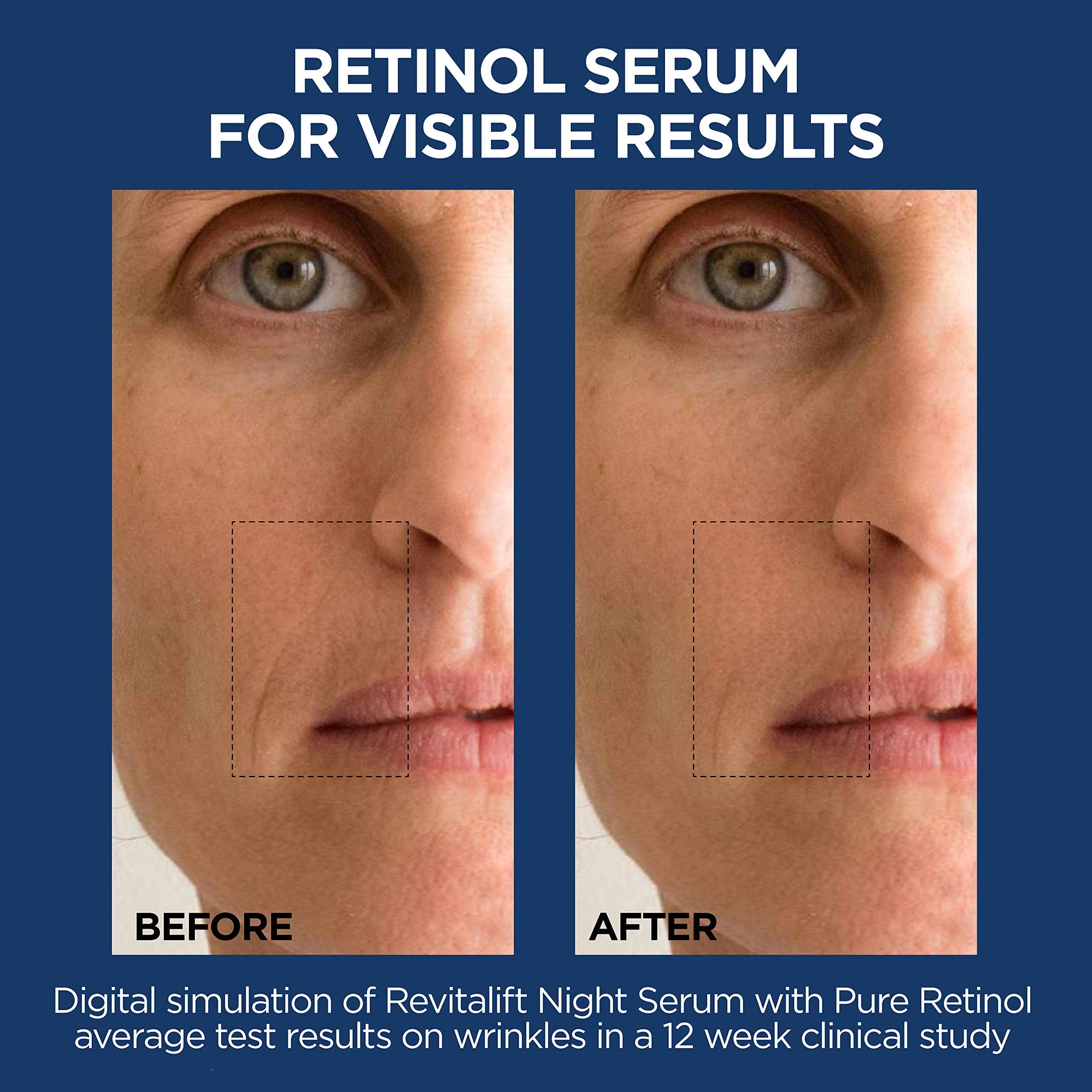 L'Oreal Paris gel-serum texture on skin showing instant plumping effect