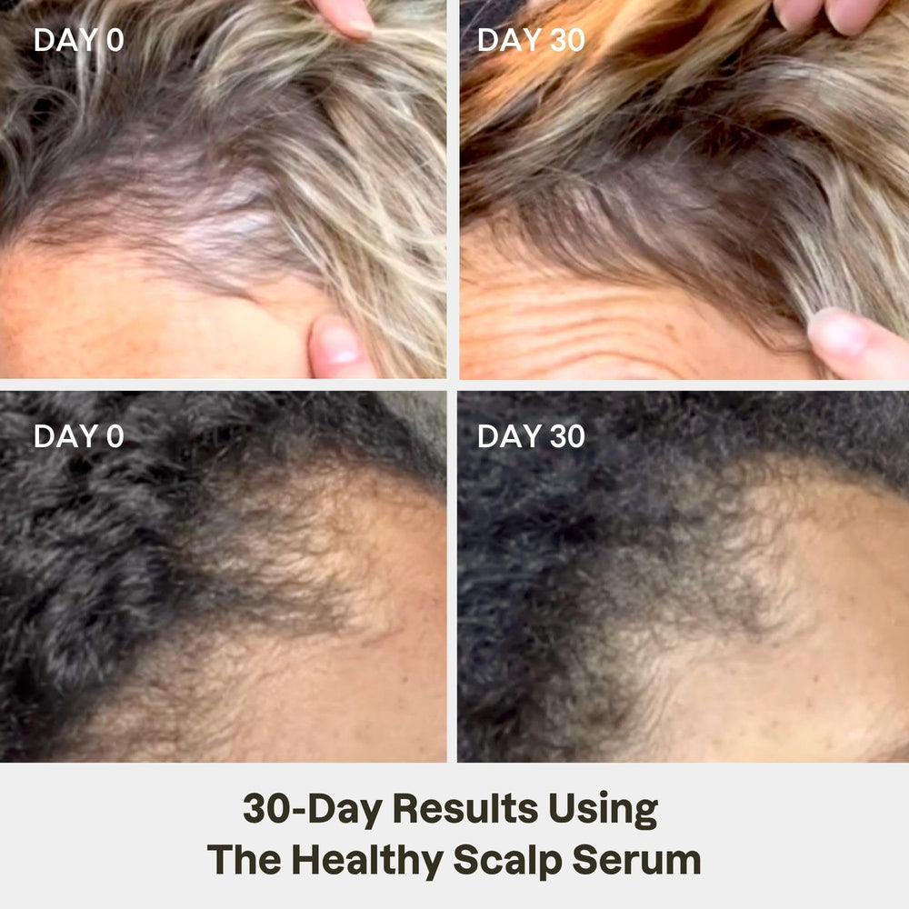 Love Ur Curls applicator close-up for precise scalp placement