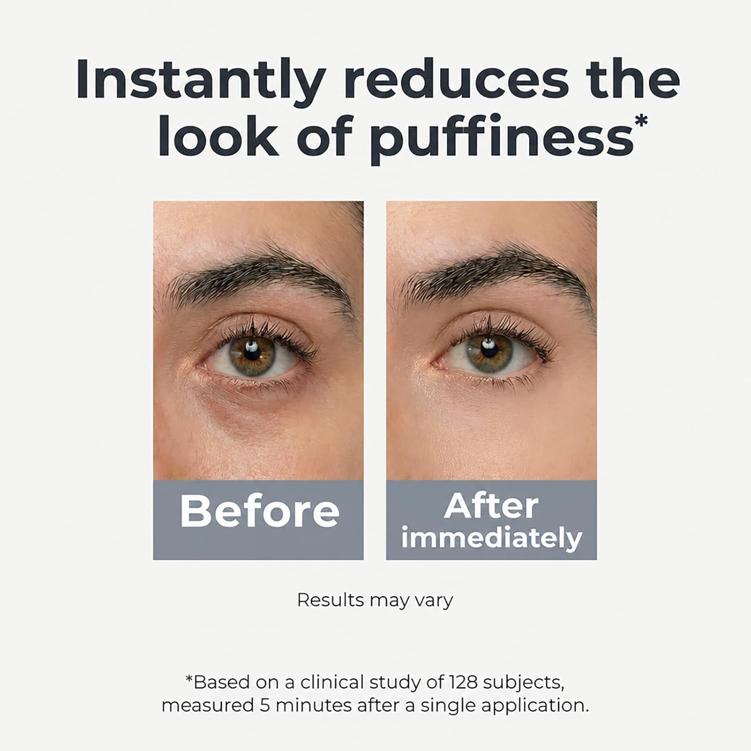 Loxadz application under-eye model demonstrating gentle roll and brightening