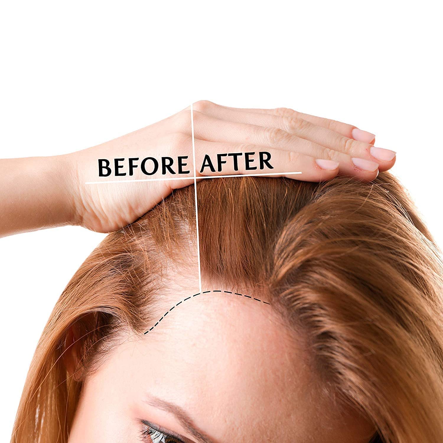 Luv Me Care dropper applying serum to scalp demonstrating precise, mess-free application