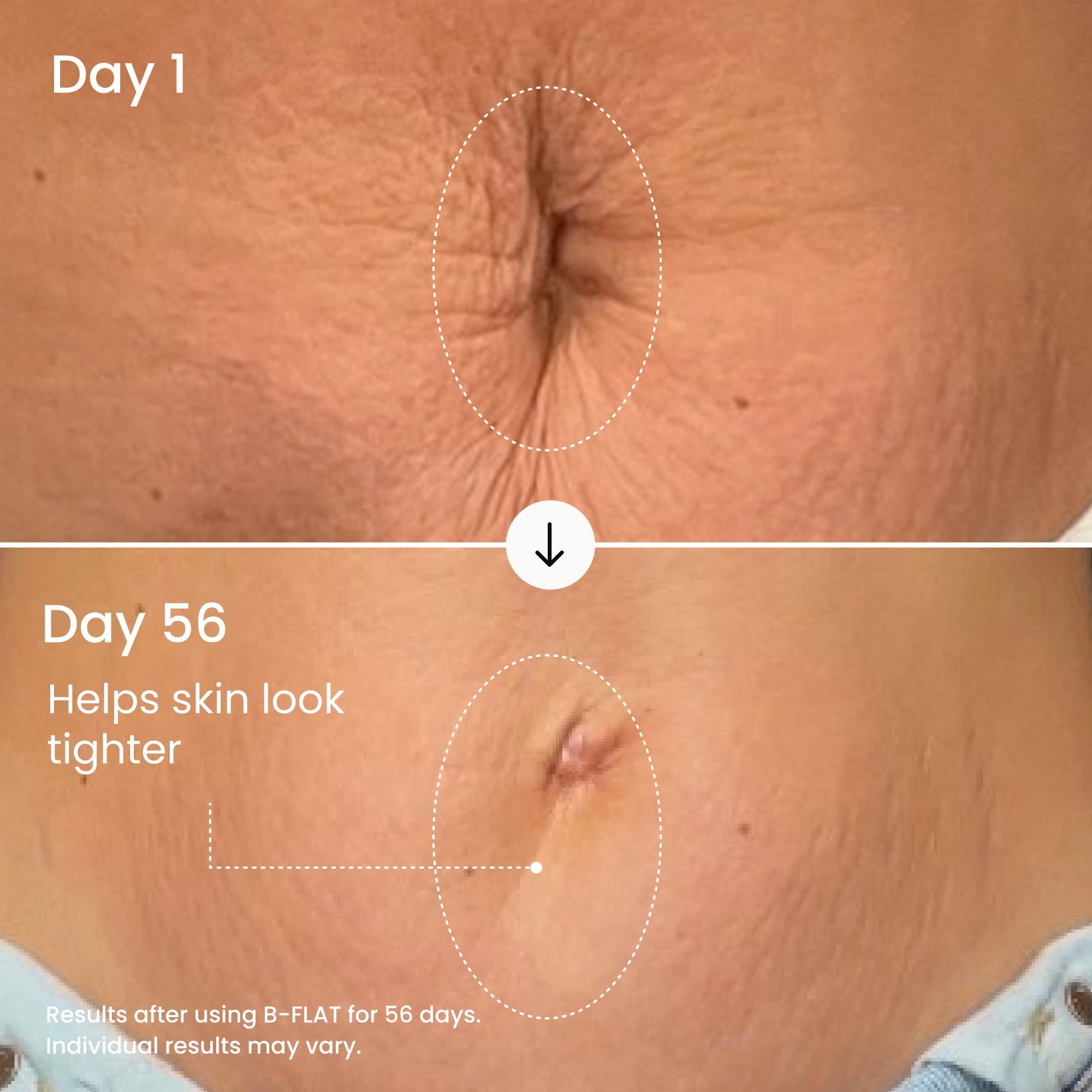 MAËLYS applied on belly showing smoother, more even-looking skin