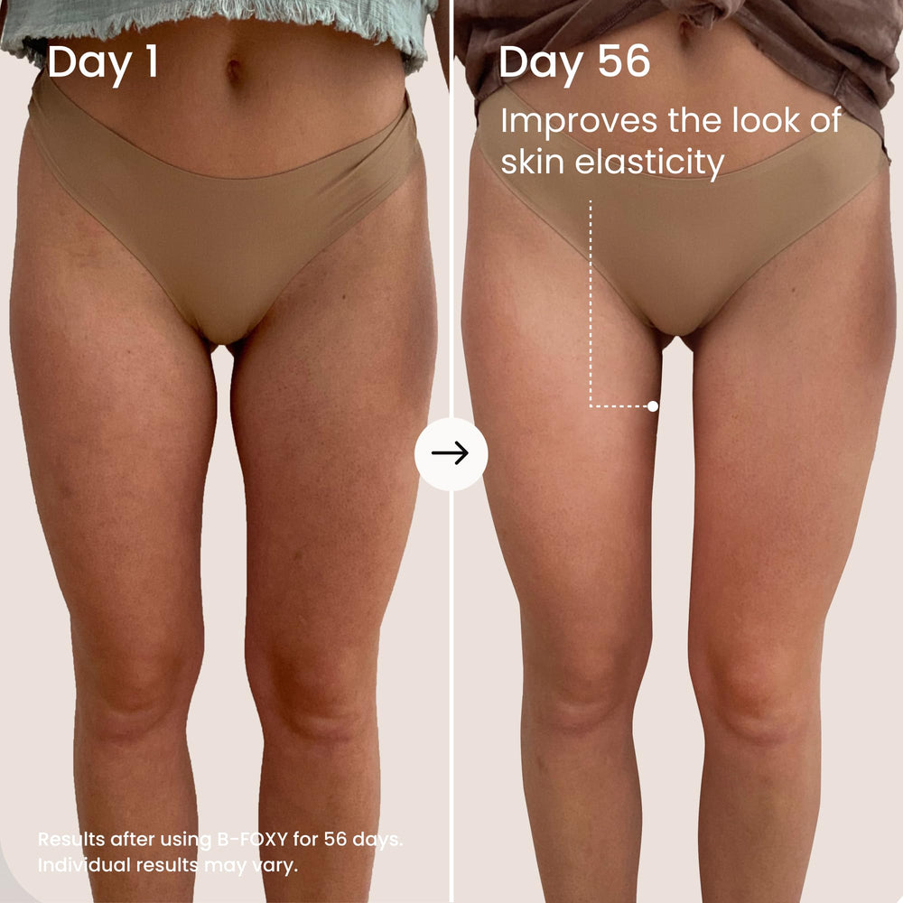 MAËLYS application on inner thigh showing anti-chafe comfort benefit