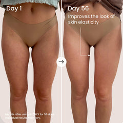 MAËLYS application on inner thigh showing anti-chafe comfort benefit